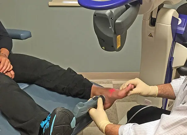 fisioterapista piede - dolori ai piedi - laserterapia per tendinite artrite e fascite plantare - centro podologico nardo