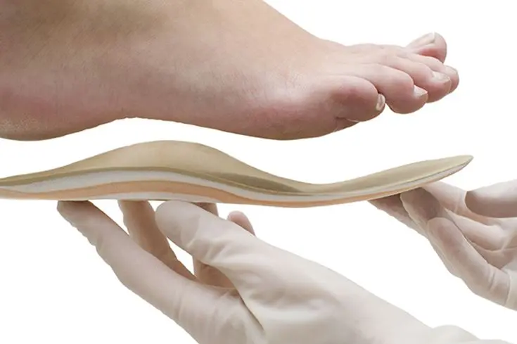 ortesi plantari - plantari su misura - Podologo Nardo - Centro Podologico Nardo