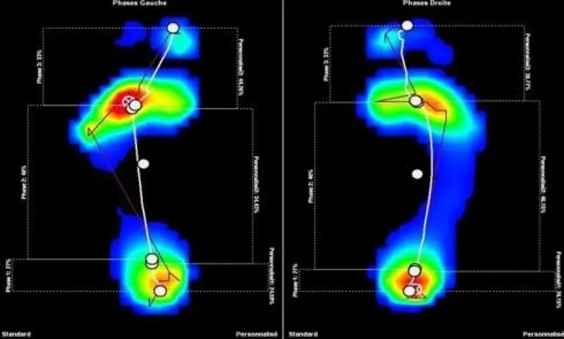 visita biomeccanica mestre - visita podologica - podologo nardo