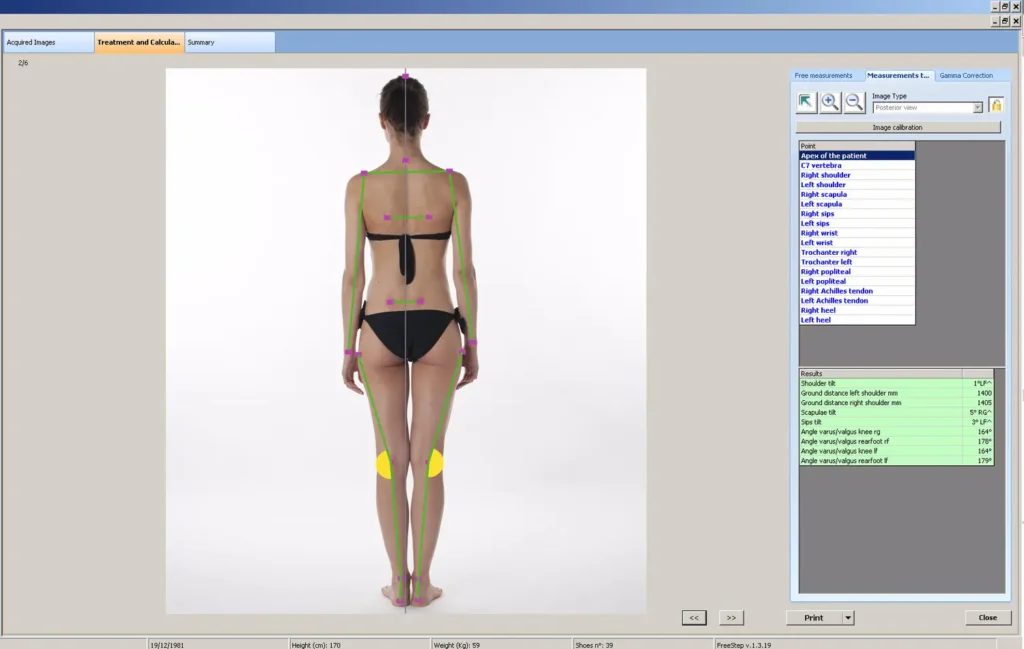 visita posturale professionale - centro podologico nardo - dott.nardo simone venezia